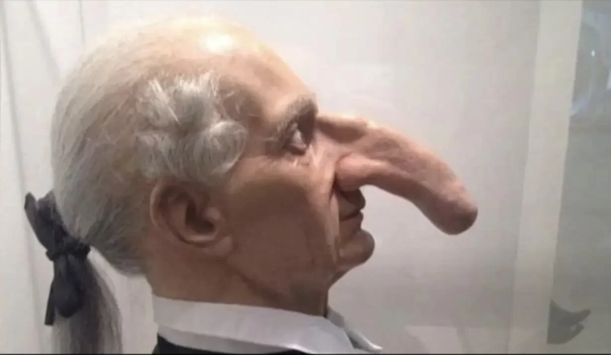 Photo Of Man With Longest Nose Goes Viral. Here's His Story